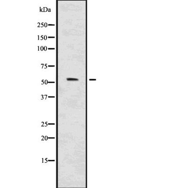 IRF7 Antibody in Western Blot (WB)