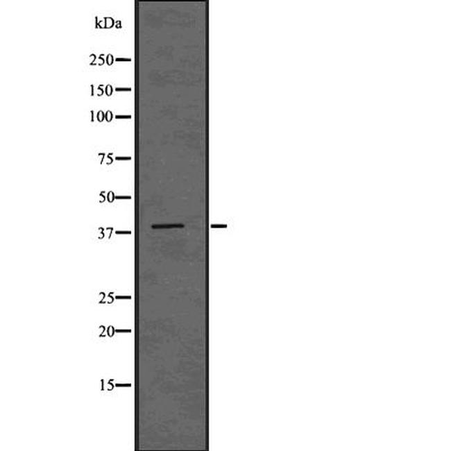 ADH6 Antibody in Western Blot (WB)