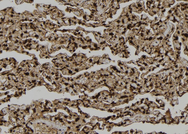 LATS2 Antibody in Immunohistochemistry (Paraffin) (IHC (P))