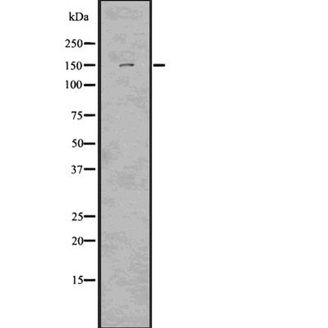 LATS2 Antibody in Western Blot (WB)