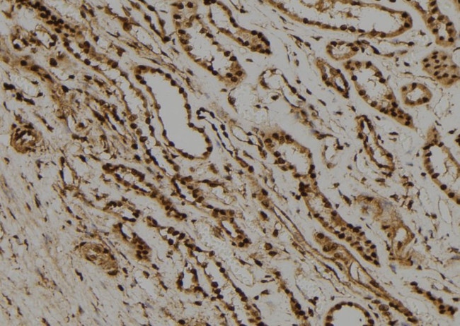 RAD21 Antibody in Immunohistochemistry (Paraffin) (IHC (P))