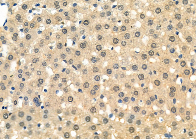 RAD21 Antibody in Immunohistochemistry (Paraffin) (IHC (P))