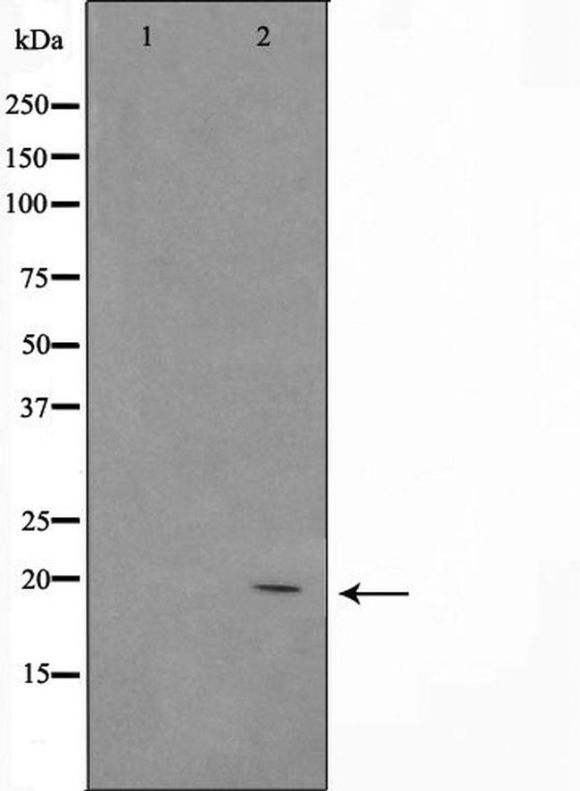 ASH2L Antibody in Western Blot (WB)