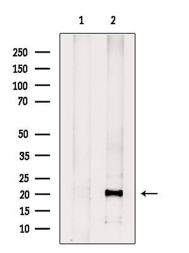 ASH2L Antibody in Western Blot (WB)