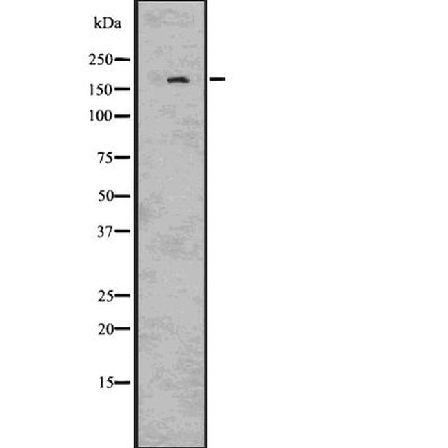 IRS2 Antibody in Western Blot (WB)