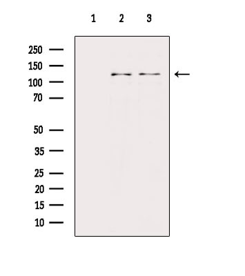 Phospho-PERK (Thr982) Antibody in Western Blot (WB)