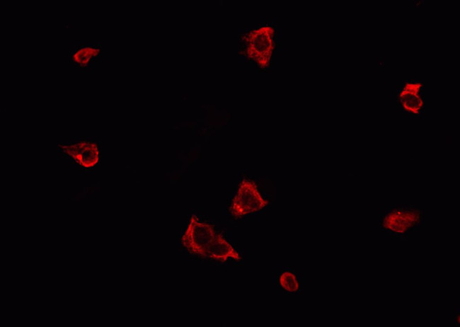 Phospho-PERK (Thr982) Antibody in Immunocytochemistry (ICC/IF)