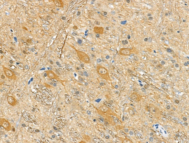 Phospho-Doublecortin (Ser335) Antibody in Immunohistochemistry (Paraffin) (IHC (P))