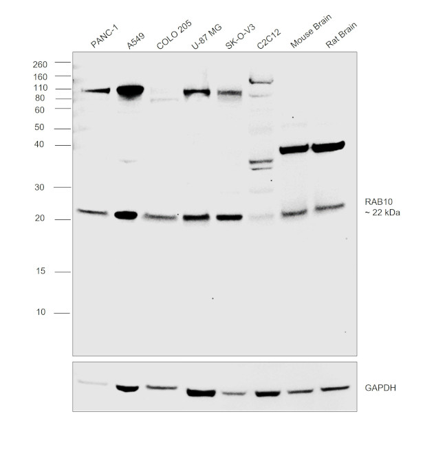 RAB10 Antibody in Western Blot (WB)