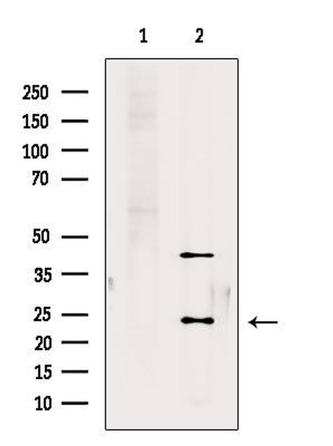 RAB10 Antibody in Western Blot (WB)