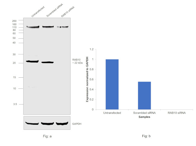 RAB10 Antibody in Western Blot (WB)