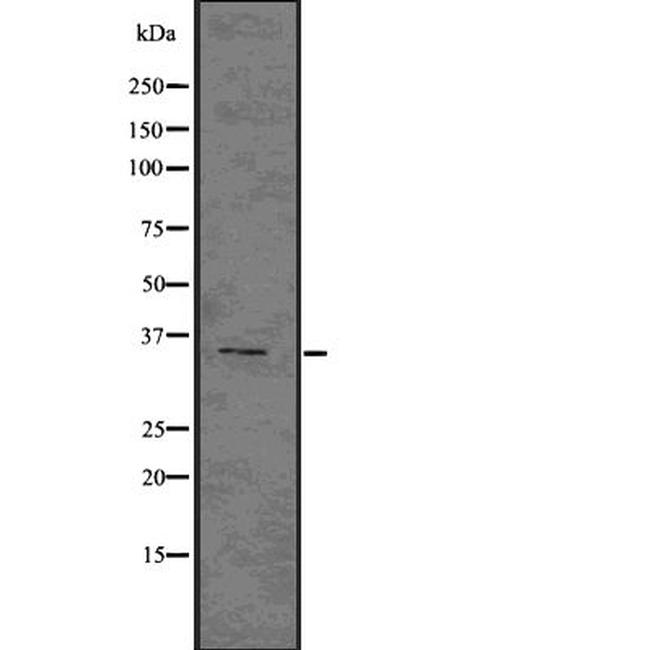 NKp46 Antibody in Western Blot (WB)