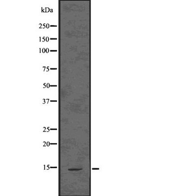 ASIP Antibody in Western Blot (WB)