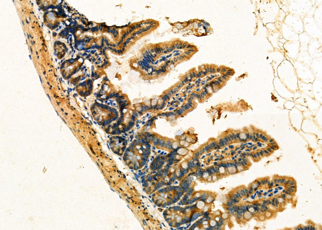 Jagged2 Antibody in Immunohistochemistry (Paraffin) (IHC (P))