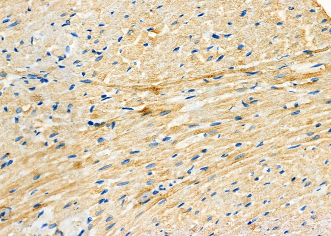 TC10 Antibody in Immunohistochemistry (Paraffin) (IHC (P))