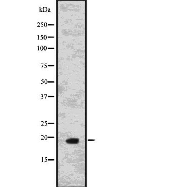 IL-15 Antibody in Western Blot (WB)