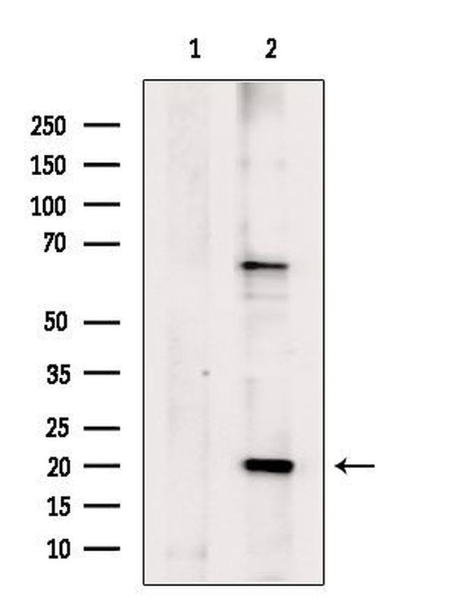 B-myc Antibody in Western Blot (WB)