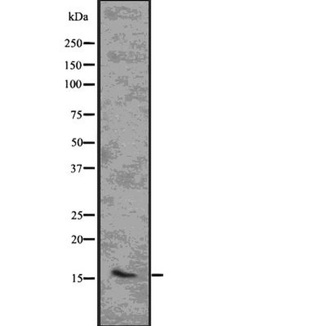 CENPA Antibody in Western Blot (WB)