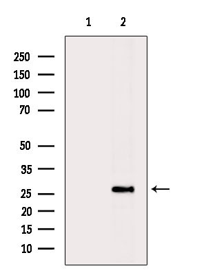 PPP1R1A Antibody in Western Blot (WB)