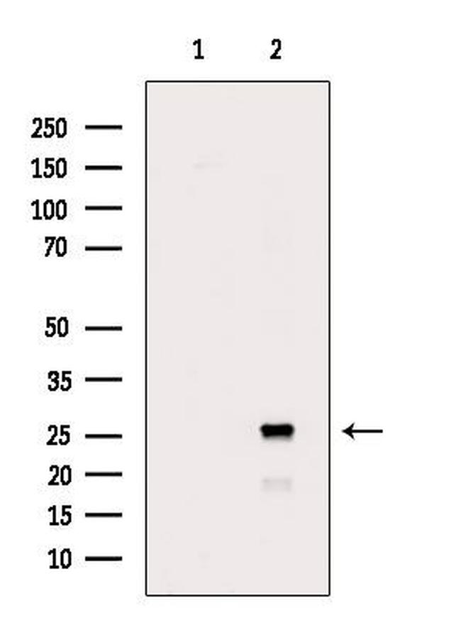 FLT3LG Antibody in Western Blot (WB)