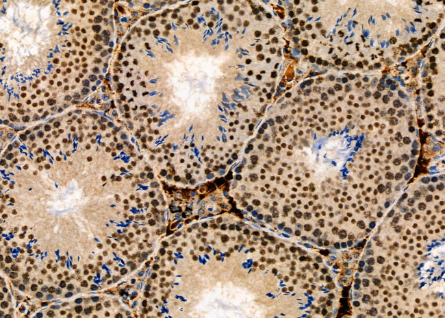 SUFU Antibody in Immunohistochemistry (Paraffin) (IHC (P))