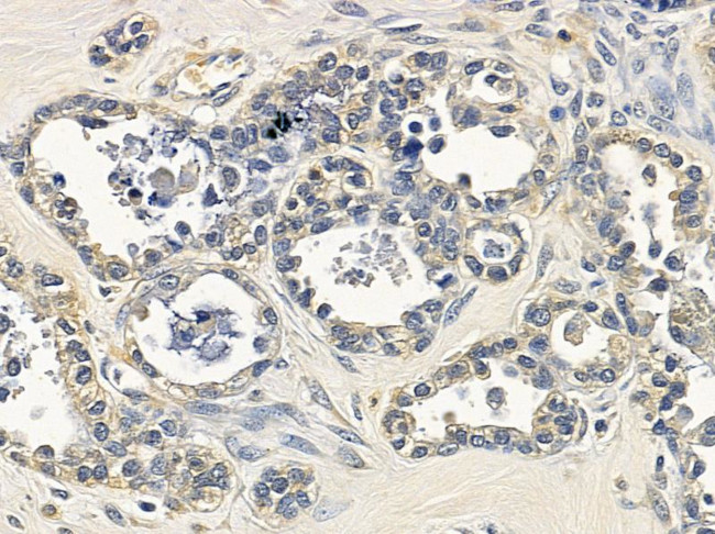 Importin 9 Antibody in Immunohistochemistry (Paraffin) (IHC (P))