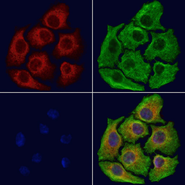 Importin 9 Antibody in Immunocytochemistry (ICC/IF)