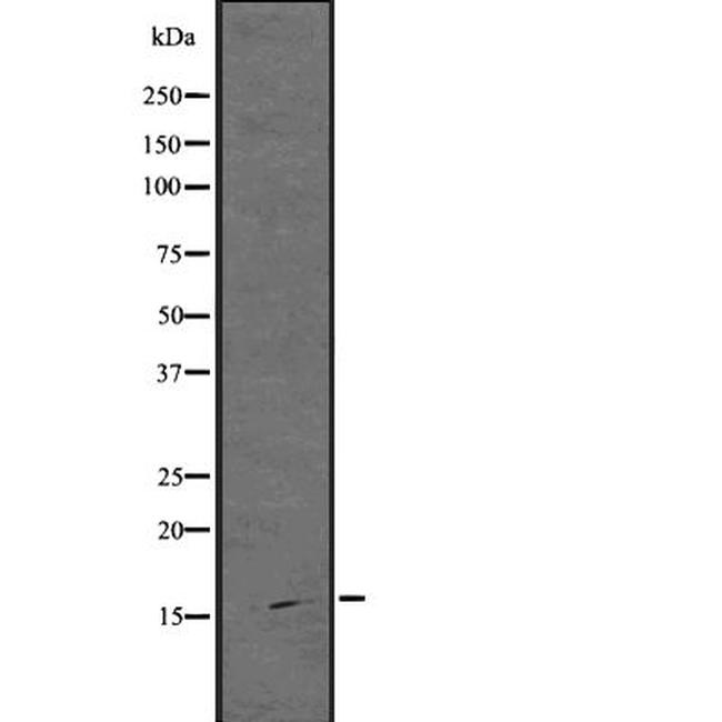 ARPC5 Antibody in Western Blot (WB)