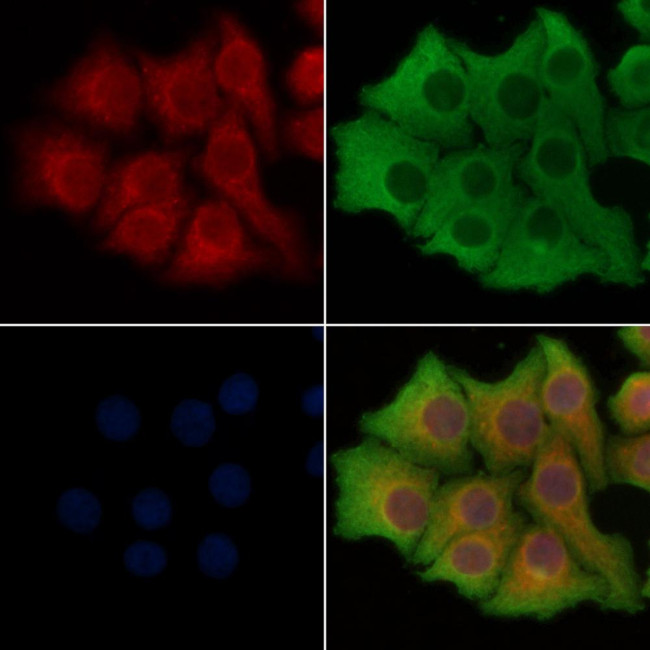 SLC27A1 Antibody in Immunocytochemistry (ICC/IF)