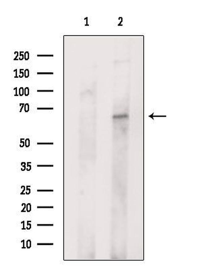 SLC27A1 Antibody in Western Blot (WB)