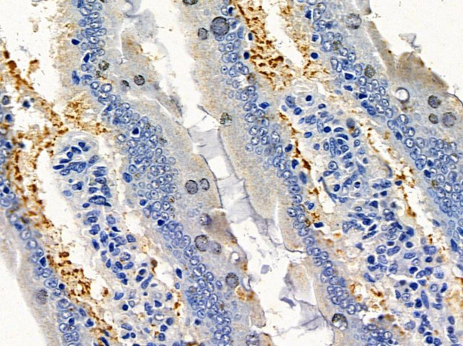 Aquaporin 7 Antibody in Immunohistochemistry (Paraffin) (IHC (P))