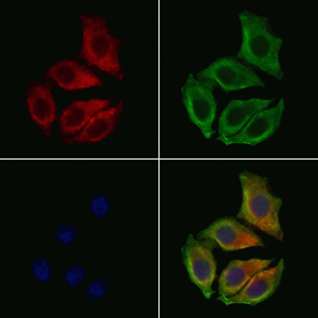 Aquaporin 7 Antibody in Immunocytochemistry (ICC/IF)