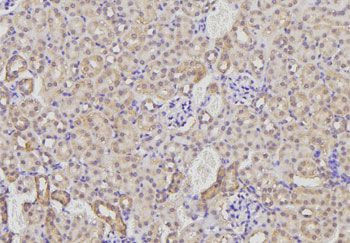 AMFR Antibody in Immunohistochemistry (IHC)