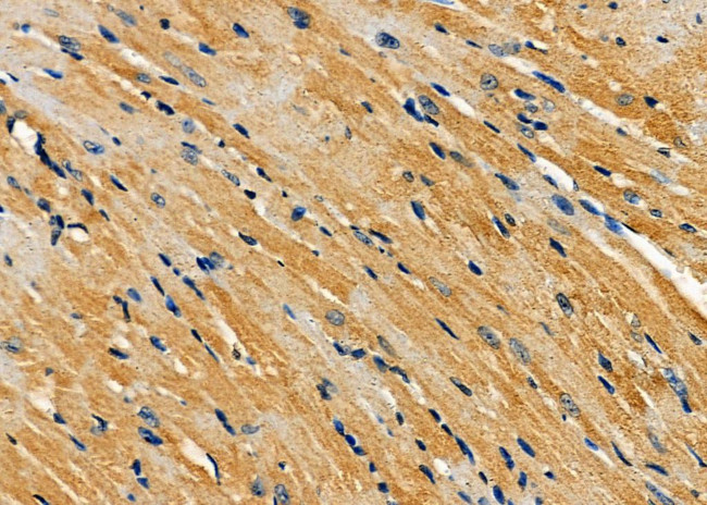 AMFR Antibody in Immunohistochemistry (Paraffin) (IHC (P))