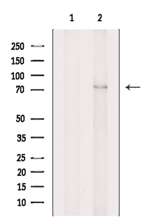 AMFR Antibody in Western Blot (WB)