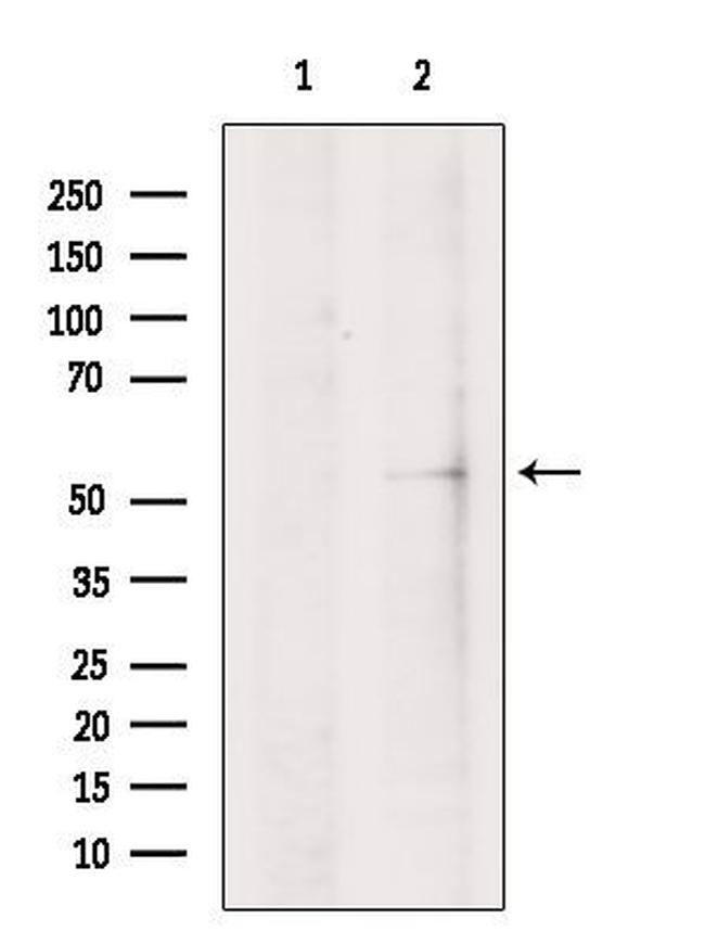 IRG1 Antibody in Western Blot (WB)