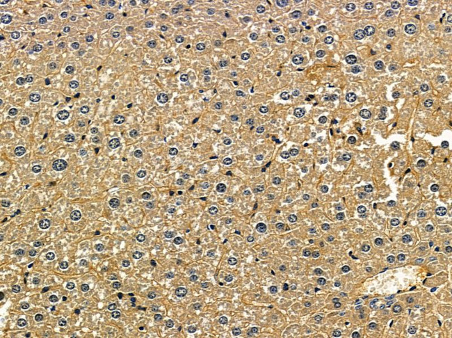 SRM Antibody in Immunohistochemistry (Paraffin) (IHC (P))