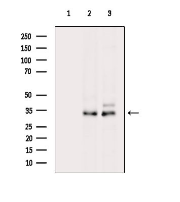 SRM Antibody in Western Blot (WB)