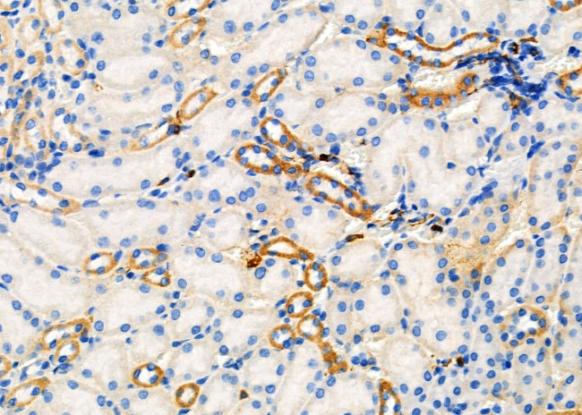 UGT2B17 Antibody in Immunohistochemistry (Paraffin) (IHC (P))