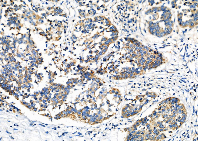 SLC39A8 Antibody in Immunohistochemistry (Paraffin) (IHC (P))