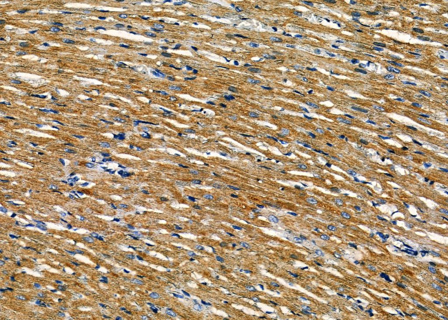 CENPE Antibody in Immunohistochemistry (Paraffin) (IHC (P))