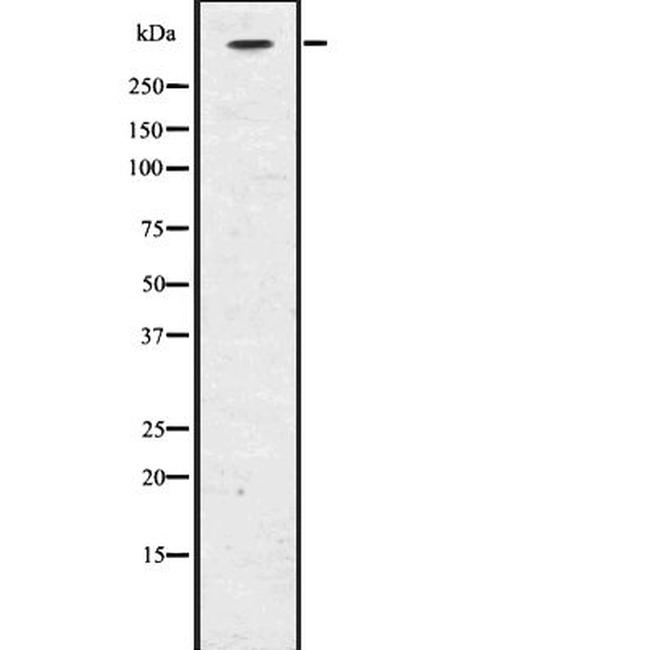 CENPE Antibody in Western Blot (WB)