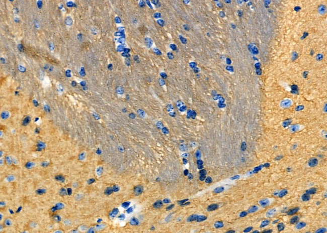 SOD3 Antibody in Immunohistochemistry (Paraffin) (IHC (P))