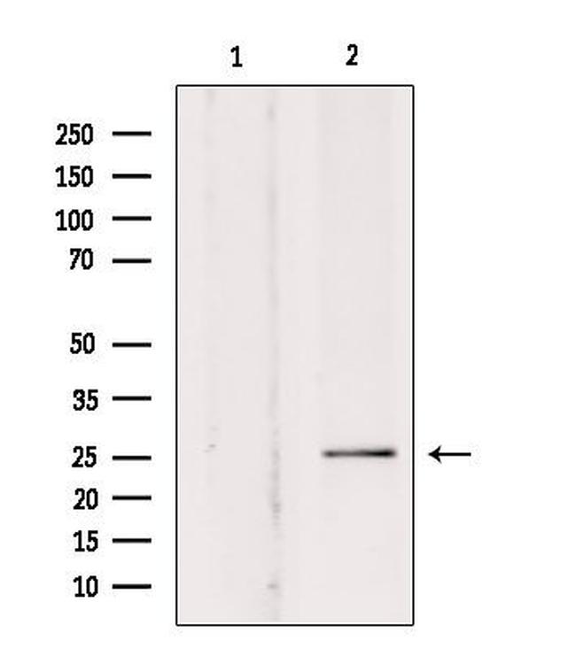 SOD3 Antibody in Western Blot (WB)