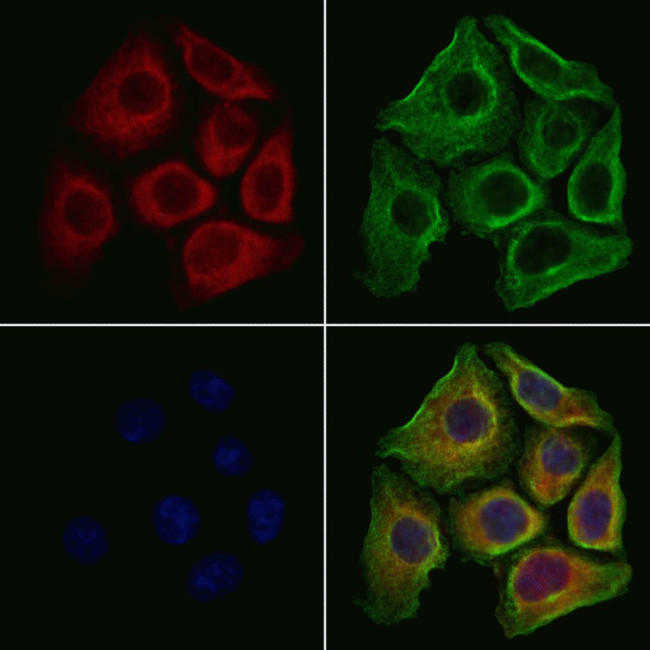 FGF3 Antibody in Immunocytochemistry (ICC/IF)