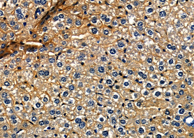 FGF3 Antibody in Immunohistochemistry (Paraffin) (IHC (P))