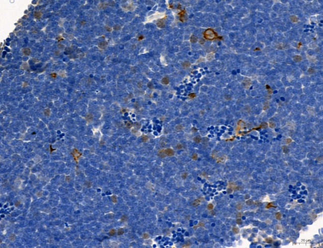 Phospho-PKM2 (Ser37) Antibody in Immunohistochemistry (Paraffin) (IHC (P))