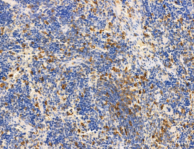 Phospho-PKM2 (Ser37) Antibody in Immunohistochemistry (Paraffin) (IHC (P))