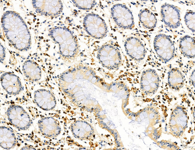 Phospho-PKM2 (Ser37) Antibody in Immunohistochemistry (Paraffin) (IHC (P))