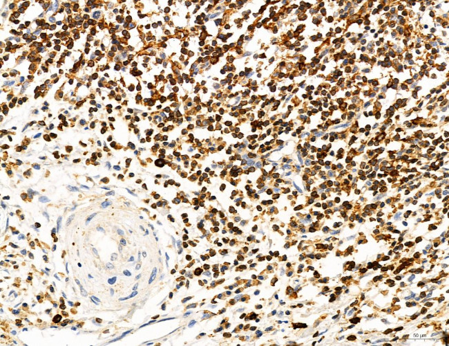 Phospho-PKM2 (Ser37) Antibody in Immunohistochemistry (Paraffin) (IHC (P))